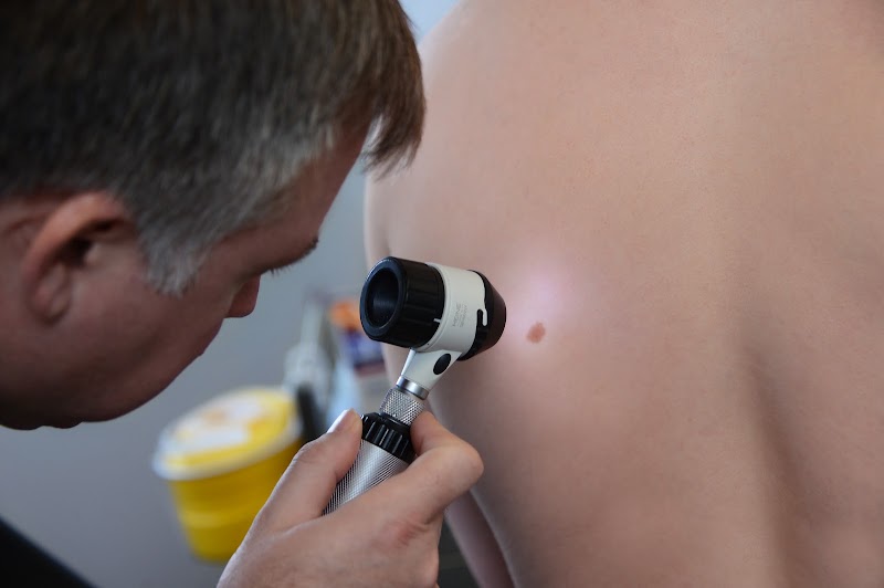 Newcastle Skin Check